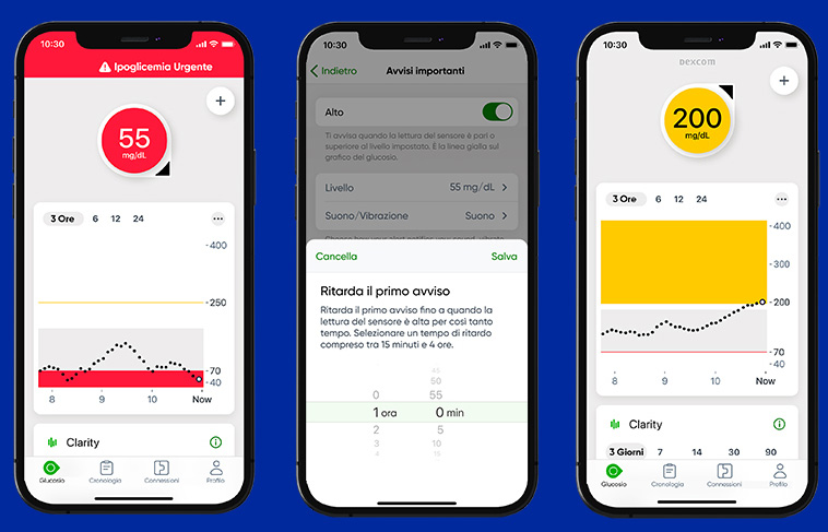 App Dexcom G7