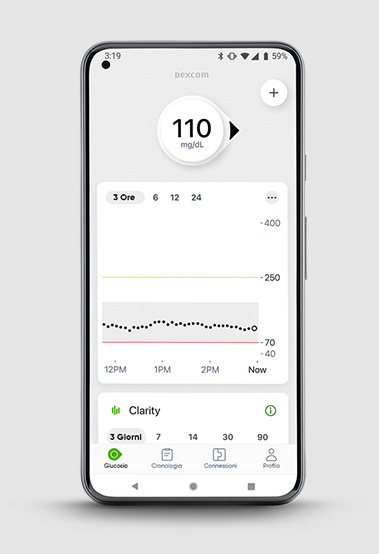 Dexcom G7